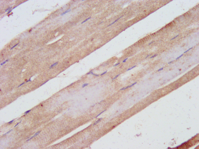 SHARPIN Antibody in Immunohistochemistry (Paraffin) (IHC (P))