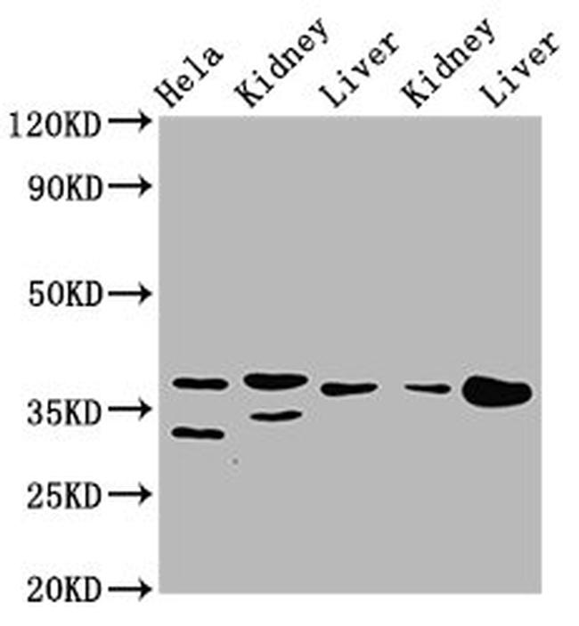 PPA2 Antibody in Western Blot (WB)