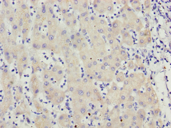 MCCC2 Antibody in Immunohistochemistry (Paraffin) (IHC (P))