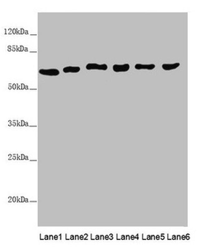 MCCC2 Antibody in Western Blot (WB)