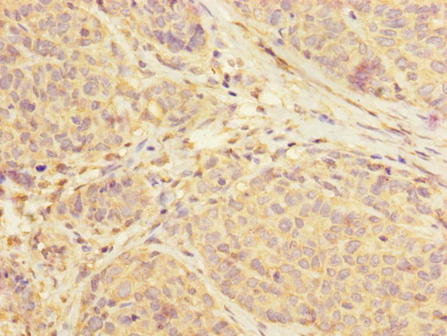 SUCLA2 Antibody in Immunohistochemistry (Paraffin) (IHC (P))