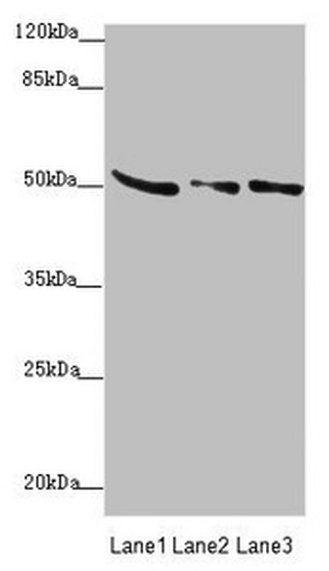 SUCLA2 Antibody in Western Blot (WB)