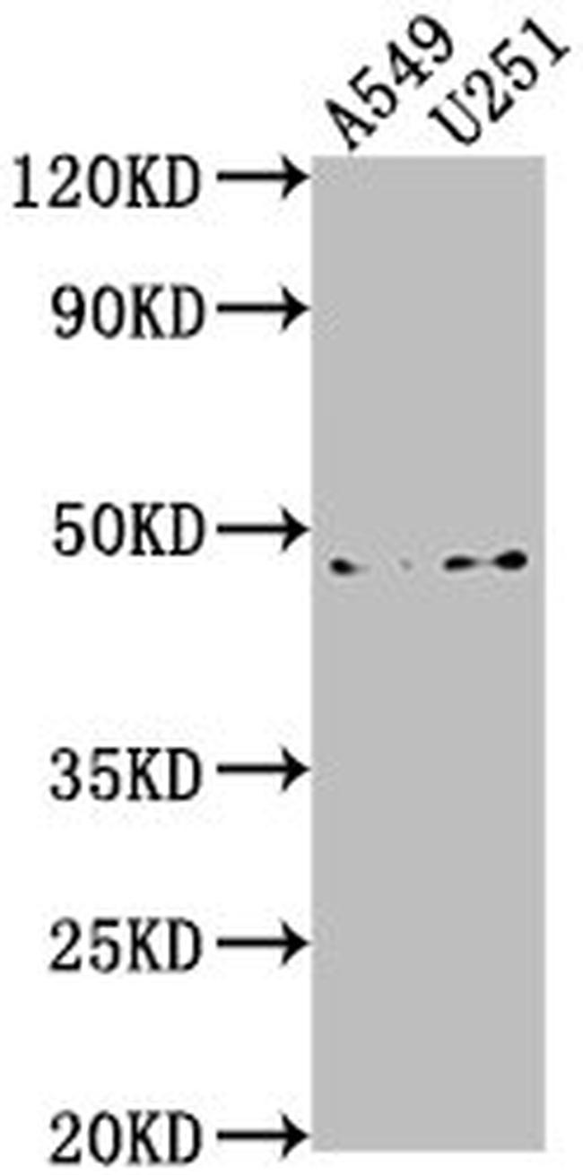 B4GALT6 Antibody in Western Blot (WB)