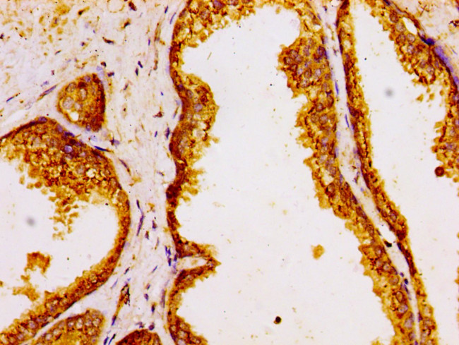 GOLPH3 Antibody in Immunohistochemistry (Paraffin) (IHC (P))