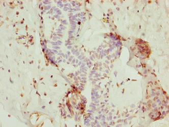 NOLA3 Antibody in Immunohistochemistry (Paraffin) (IHC (P))