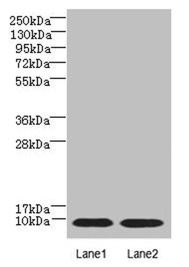 NOLA3 Antibody in Western Blot (WB)