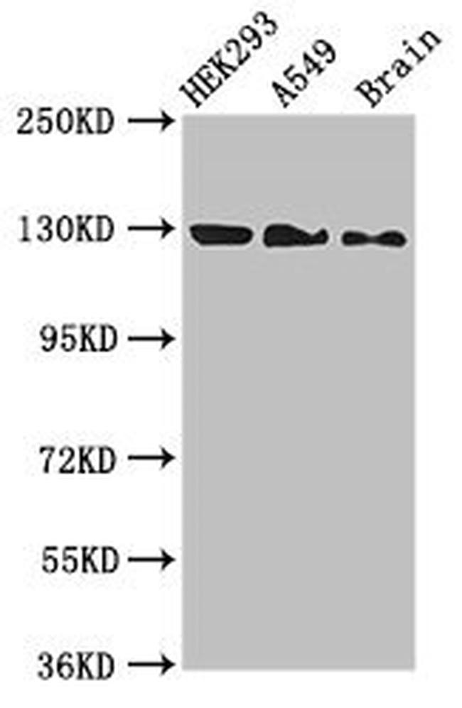 eIF4ENIF1 Antibody in Western Blot (WB)