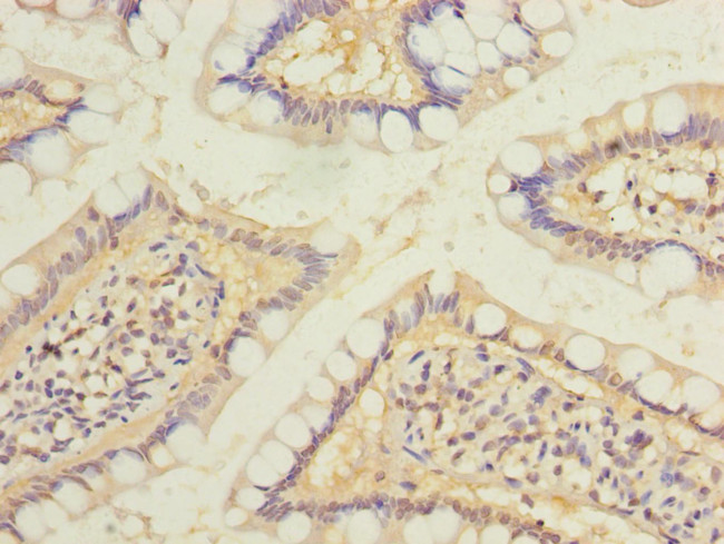 RAB6B Antibody in Immunohistochemistry (Paraffin) (IHC (P))