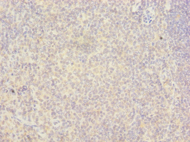 RAB6B Antibody in Immunohistochemistry (Paraffin) (IHC (P))