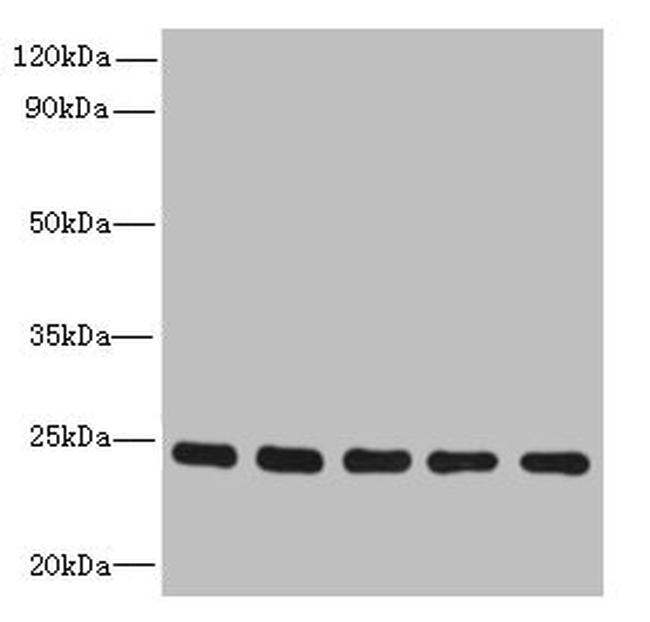 RAB6B Antibody in Western Blot (WB)