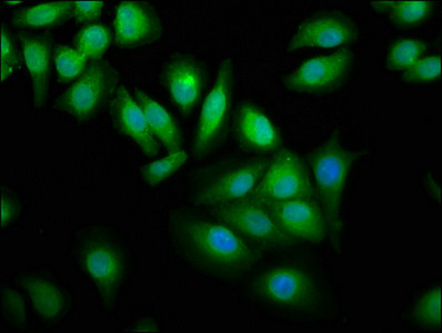 WWOX Antibody in Immunocytochemistry (ICC/IF)