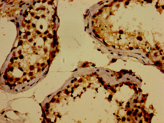 WWOX Antibody in Immunohistochemistry (Paraffin) (IHC (P))