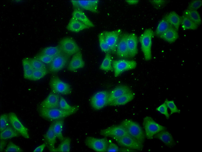 LARS Antibody in Immunocytochemistry (ICC/IF)