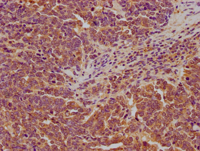 LARS Antibody in Immunohistochemistry (Paraffin) (IHC (P))