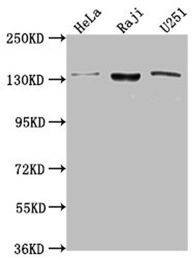 LARS Antibody in Western Blot (WB)