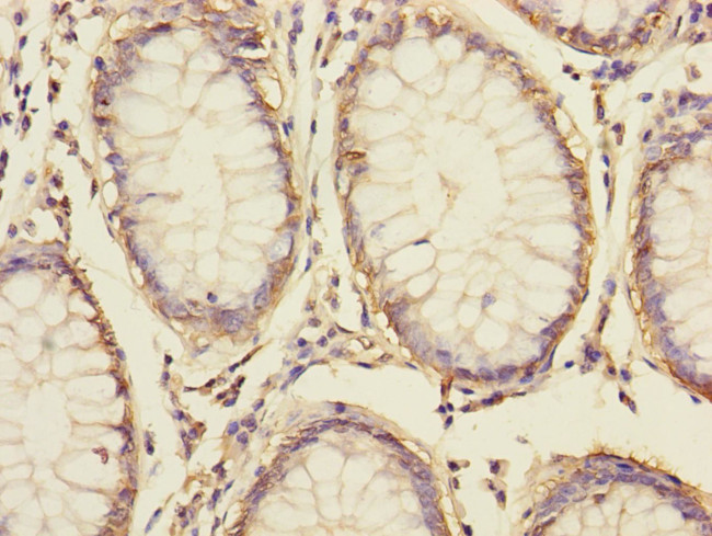 S100A14 Antibody in Immunohistochemistry (Paraffin) (IHC (P))