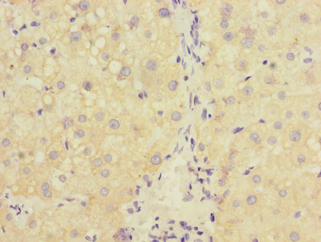 RAB18 Antibody in Immunohistochemistry (Paraffin) (IHC (P))