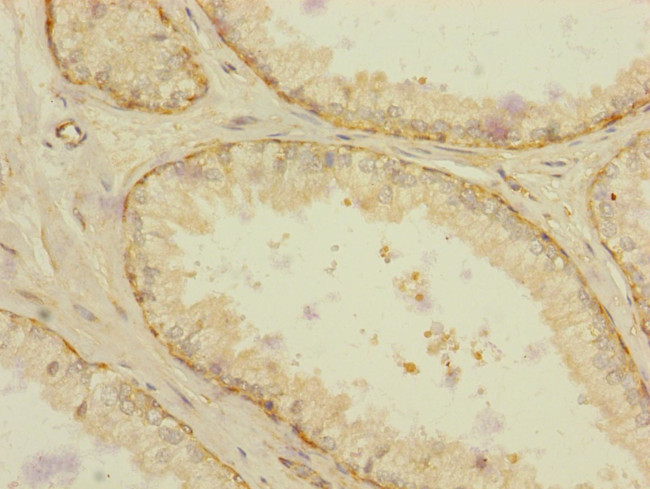 RAB18 Antibody in Immunohistochemistry (Paraffin) (IHC (P))