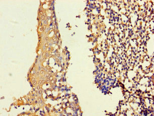 ASF1B Antibody in Immunohistochemistry (Paraffin) (IHC (P))