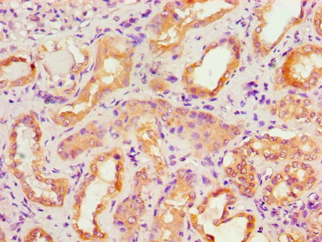 ACTR3B Antibody in Immunohistochemistry (Paraffin) (IHC (P))