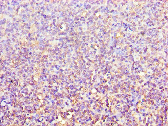 ACTR3B Antibody in Immunohistochemistry (Paraffin) (IHC (P))