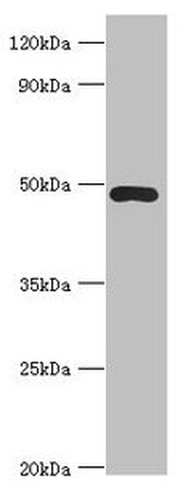 ACTR3B Antibody in Western Blot (WB)