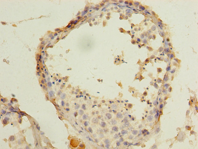 ACTRT3 Antibody in Immunohistochemistry (Paraffin) (IHC (P))