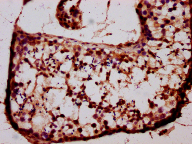 BARHL1 Antibody in Immunohistochemistry (Paraffin) (IHC (P))