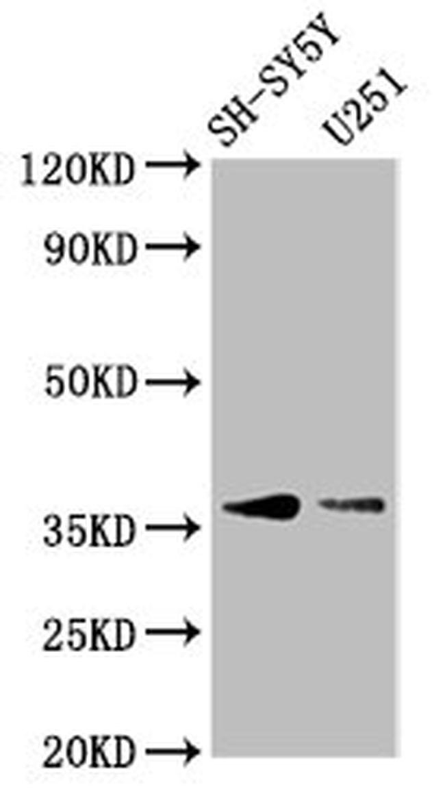 BARHL1 Antibody in Western Blot (WB)