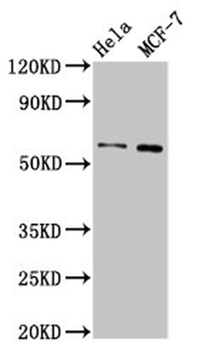 MMP28 Antibody in Western Blot (WB)