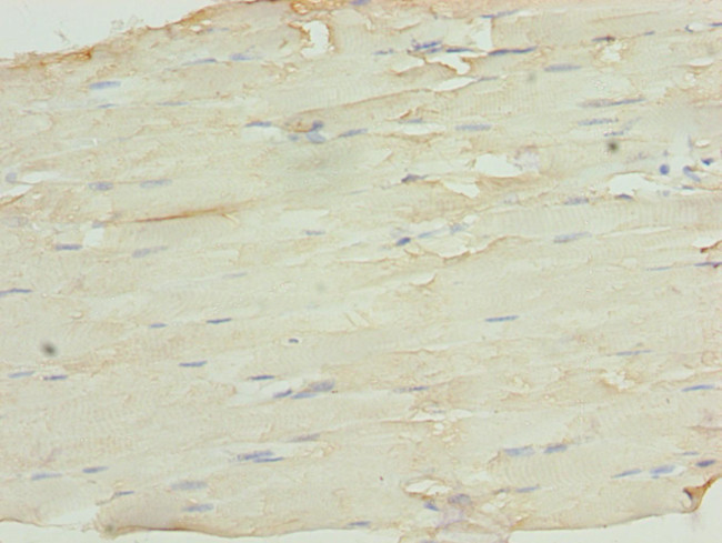 SH3BGRL3 Antibody in Immunohistochemistry (Paraffin) (IHC (P))