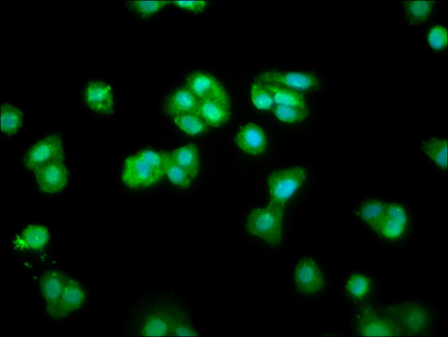 CHMP1A Antibody in Immunocytochemistry (ICC/IF)