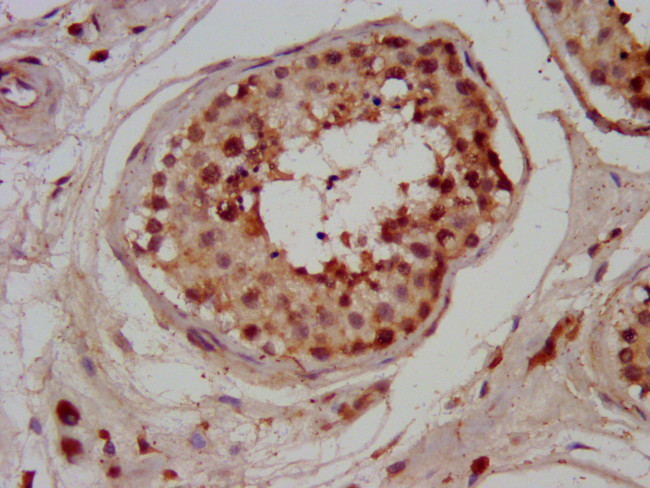 CHMP1A Antibody in Immunohistochemistry (Paraffin) (IHC (P))