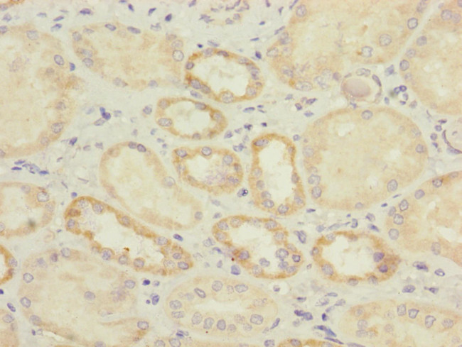 IL17RB Antibody in Immunohistochemistry (Paraffin) (IHC (P))