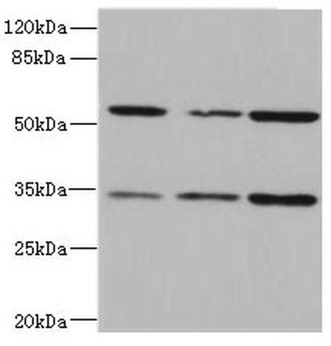 IL17RB Antibody in Western Blot (WB)