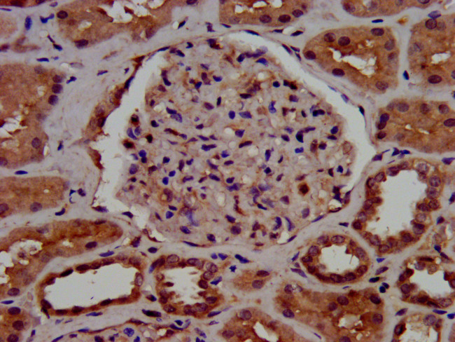 C1GALT1 Antibody in Immunohistochemistry (Paraffin) (IHC (P))