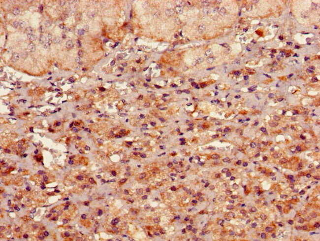 RMND1 Antibody in Immunohistochemistry (Paraffin) (IHC (P))