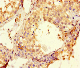 BTNL2 Antibody in Immunohistochemistry (Paraffin) (IHC (P))