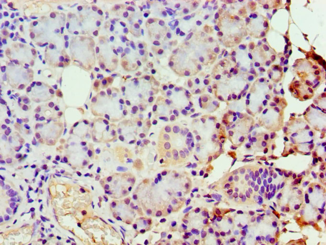 GBA3 Antibody in Immunohistochemistry (Paraffin) (IHC (P))