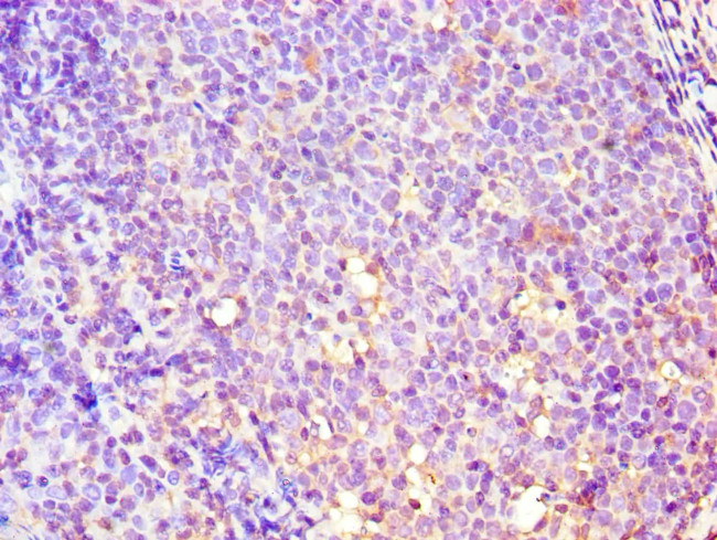 GBA3 Antibody in Immunohistochemistry (Paraffin) (IHC (P))