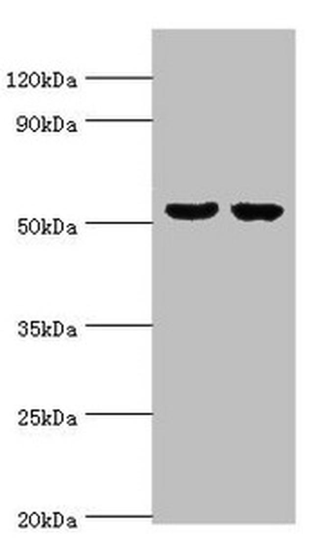 GBA3 Antibody in Western Blot (WB)