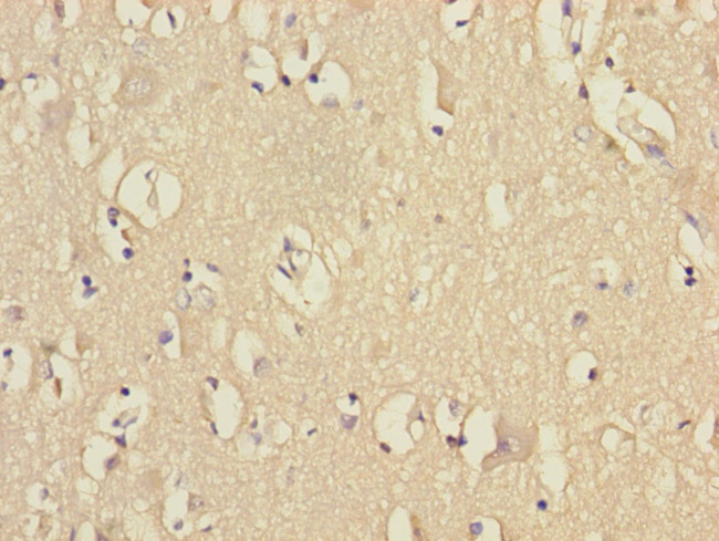 VPS33B Antibody in Immunohistochemistry (Paraffin) (IHC (P))