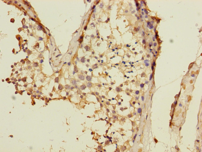 VPS33B Antibody in Immunohistochemistry (Paraffin) (IHC (P))