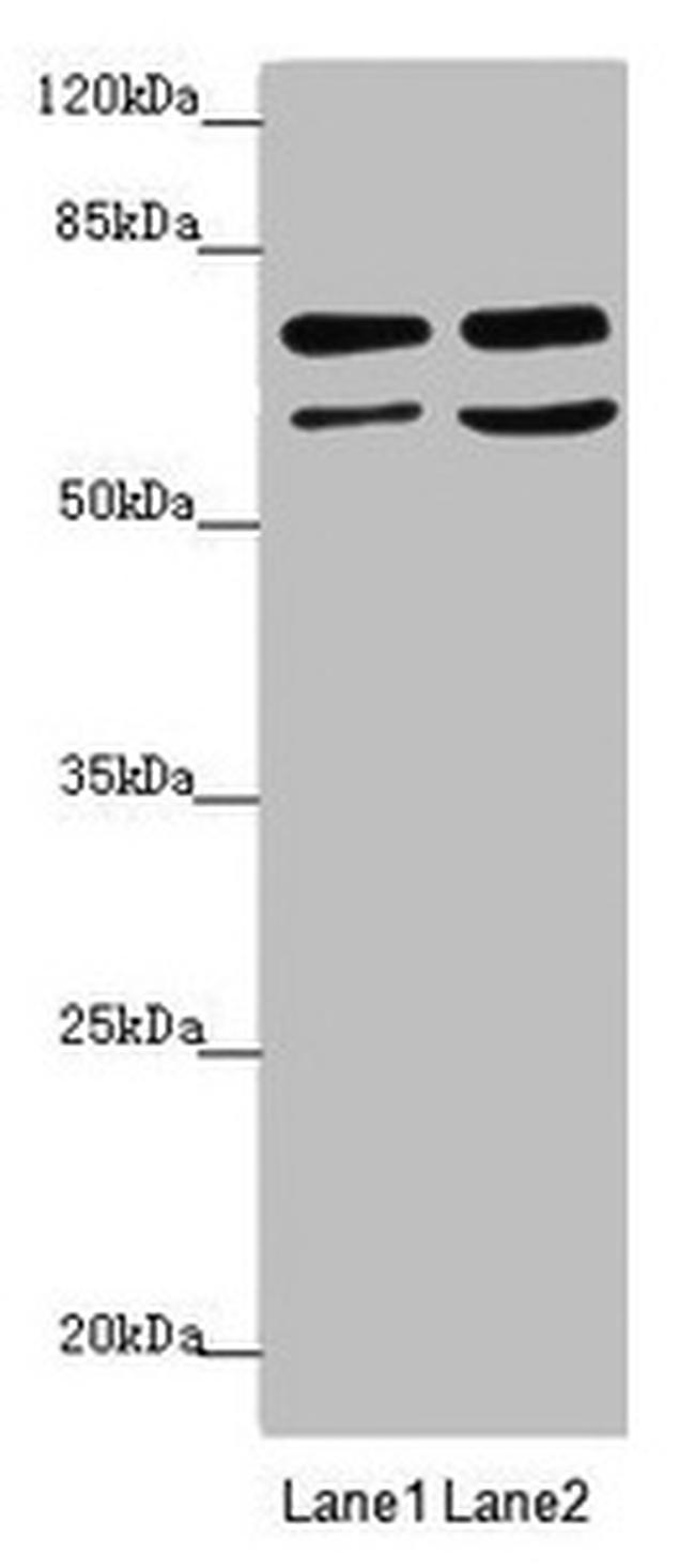 VPS33B Antibody in Western Blot (WB)