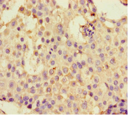 DHX33 Antibody in Immunohistochemistry (Paraffin) (IHC (P))