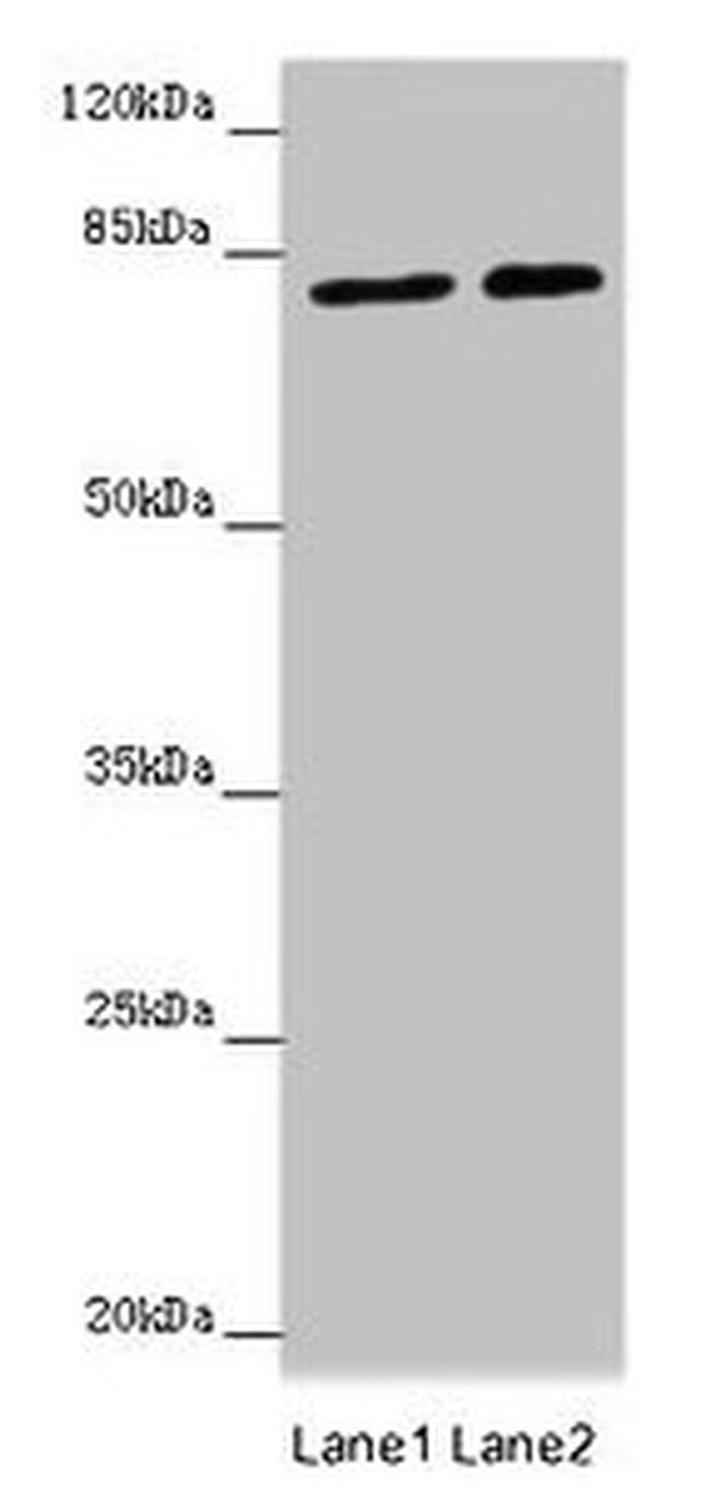 DHX33 Antibody in Western Blot (WB)