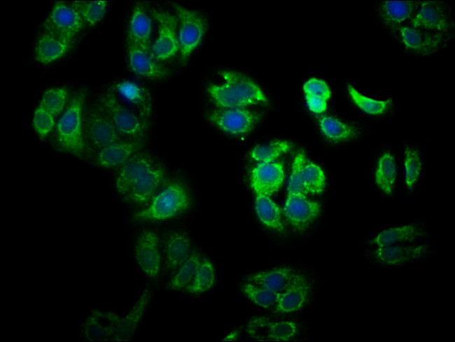 YY1AP1 Antibody in Immunocytochemistry (ICC/IF)