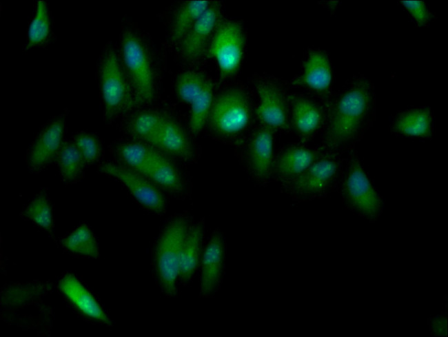 ELP3 Antibody in Immunocytochemistry (ICC/IF)