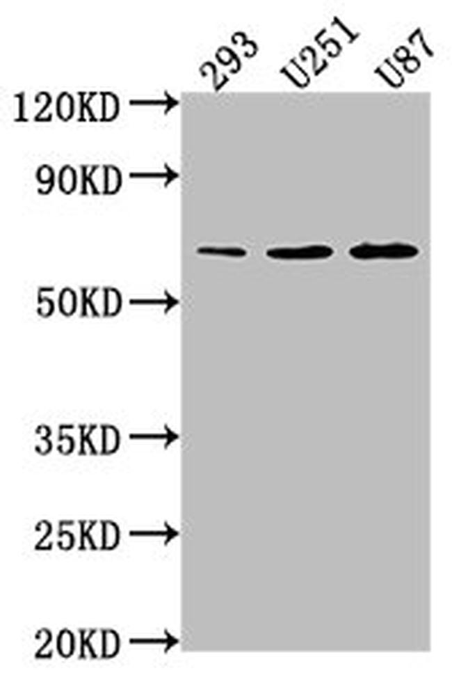 TCF7L1 Antibody in Western Blot (WB)