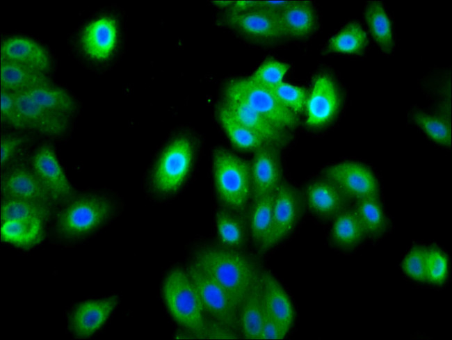 FAM83D Antibody in Immunocytochemistry (ICC/IF)